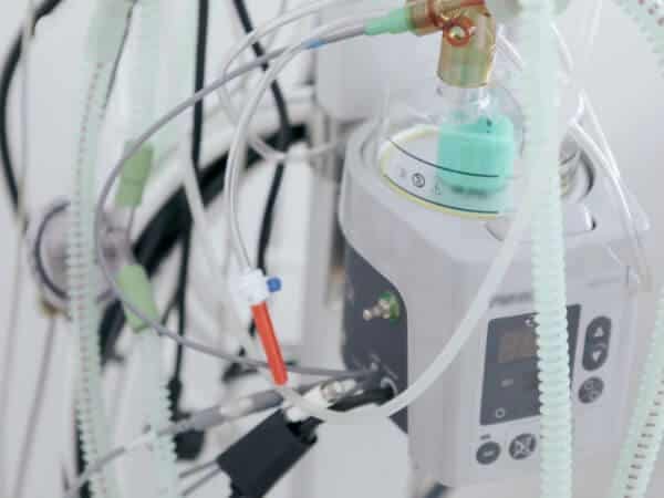 ecmo medicina